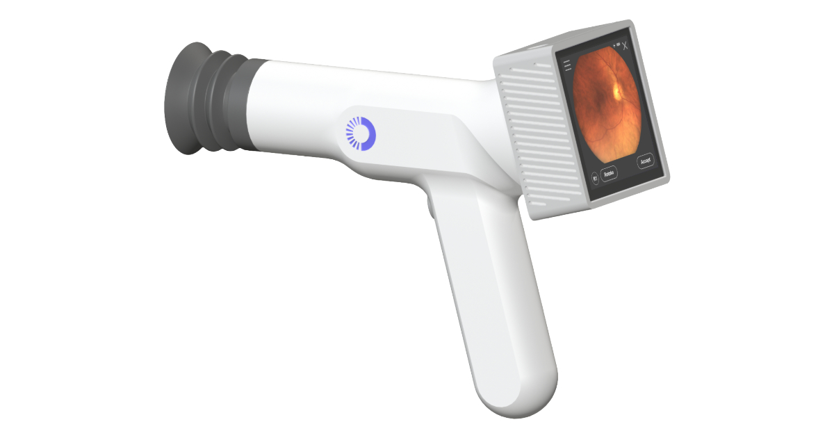 AI Optics a primit aprobarea FDA 510(k) pentru camera de screening retinal.